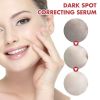 Hoygi Black Spot Repair Essence Lighten Skin Black Spot And Age Spot Moisturizing&Brightening Repair Essence