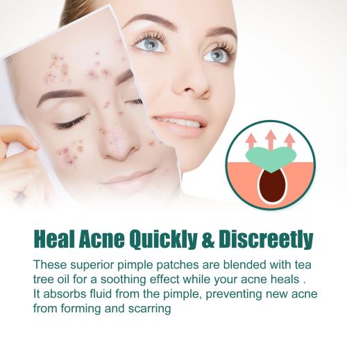 EELHOE Love Acne Patch Gentle Cleansing Acne Patch Fades Facial Acne Marks And Spots Facial Cleansing Care
